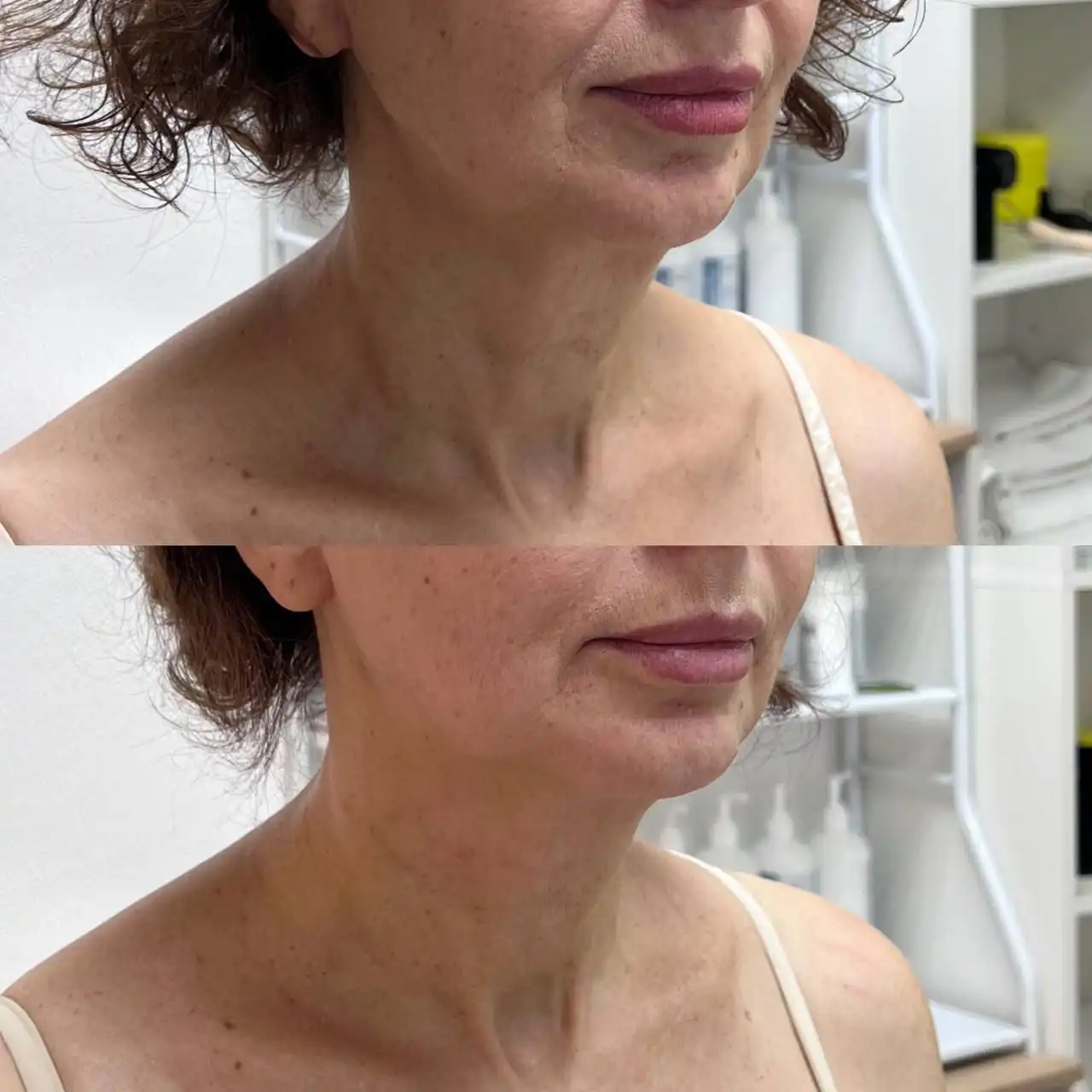 Глубокотканый массаж лица в клинике доктора Князева - Красота и здоровье (Услуги) в Сургут