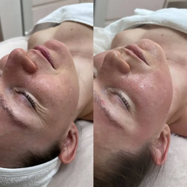 Скульптурный массаж лица в Сургуте - частное объявление в Сургут