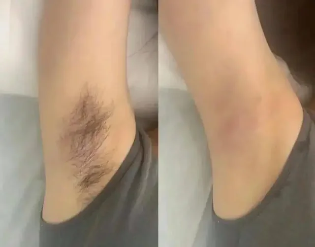 Депиляция в мастерской здоровья и красоты - Авиаперевозки в Сургут