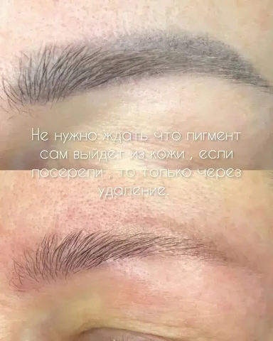 Удаление татуажа бровей в Сургуте - Электромонтажные работы в Сургут