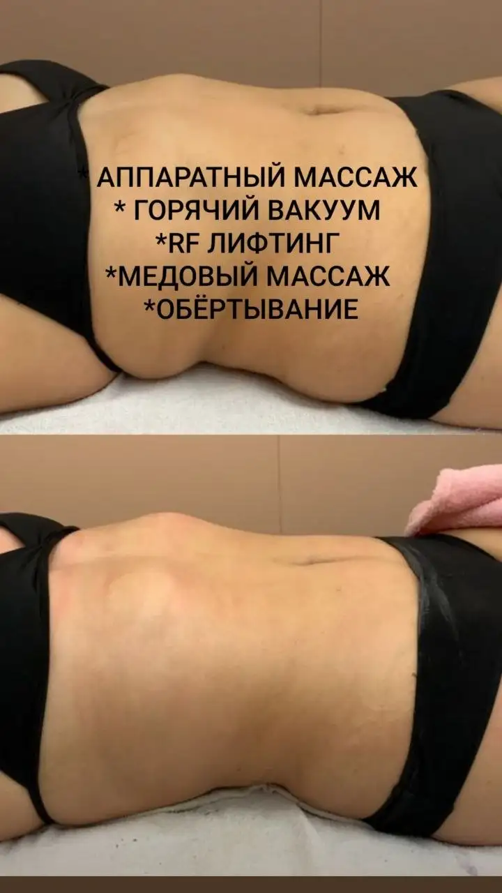 Массаж для упругой кожи - Красота и здоровье в Сургут