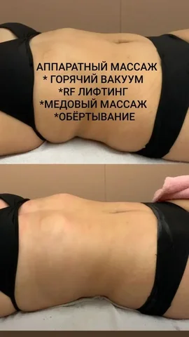Массаж для упругой кожи - Снижение веса в Сургут