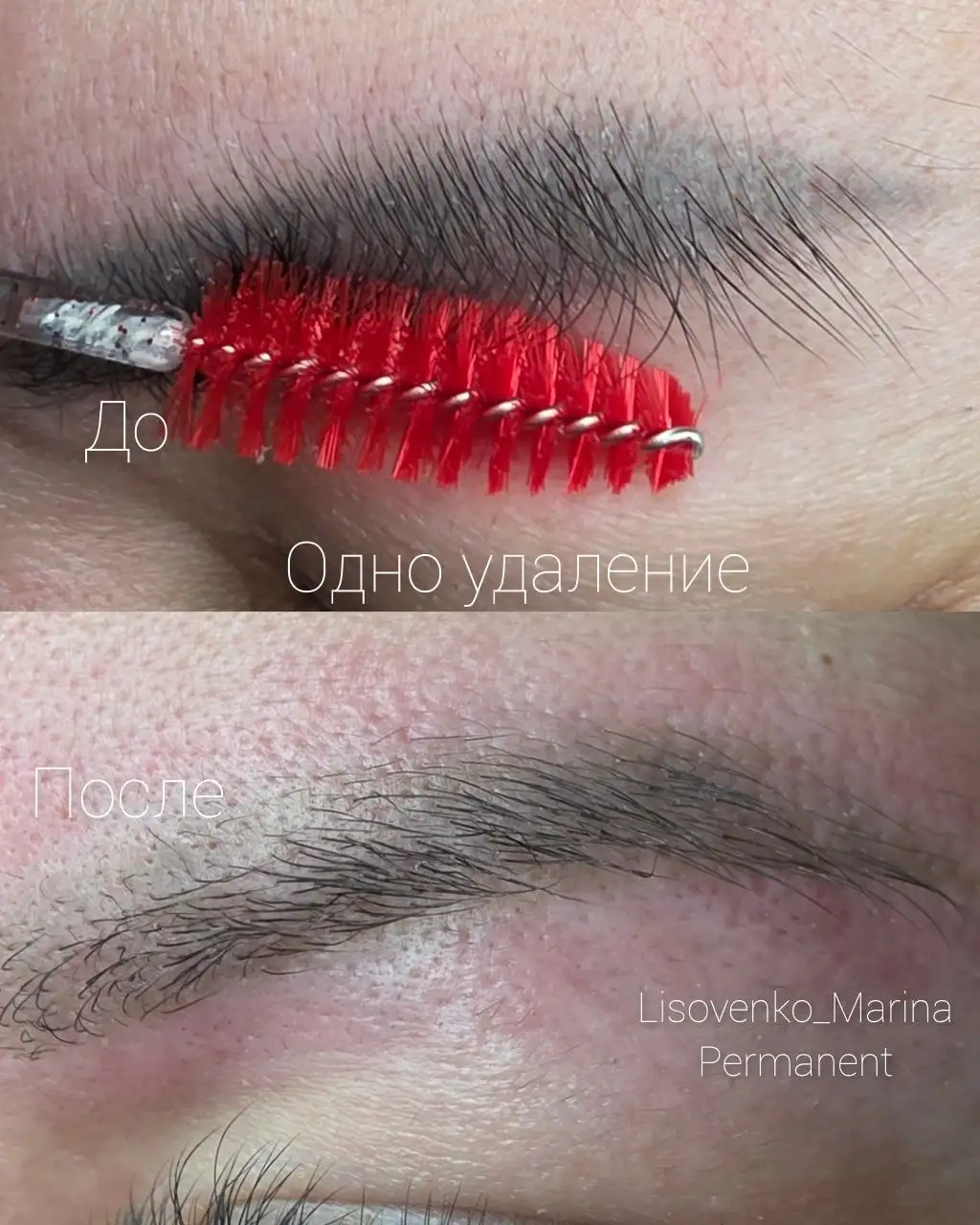 Удаление татуировок и перманента, консультация бесплатно - Услуги красоты и здоровья (Услуги) в Сургут