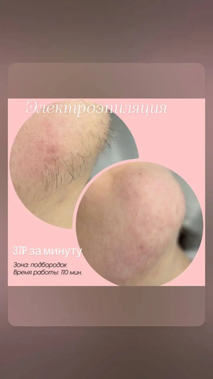Косметологические и медицинские услуги в Сургуте - Косметология (Услуги) в Сургут