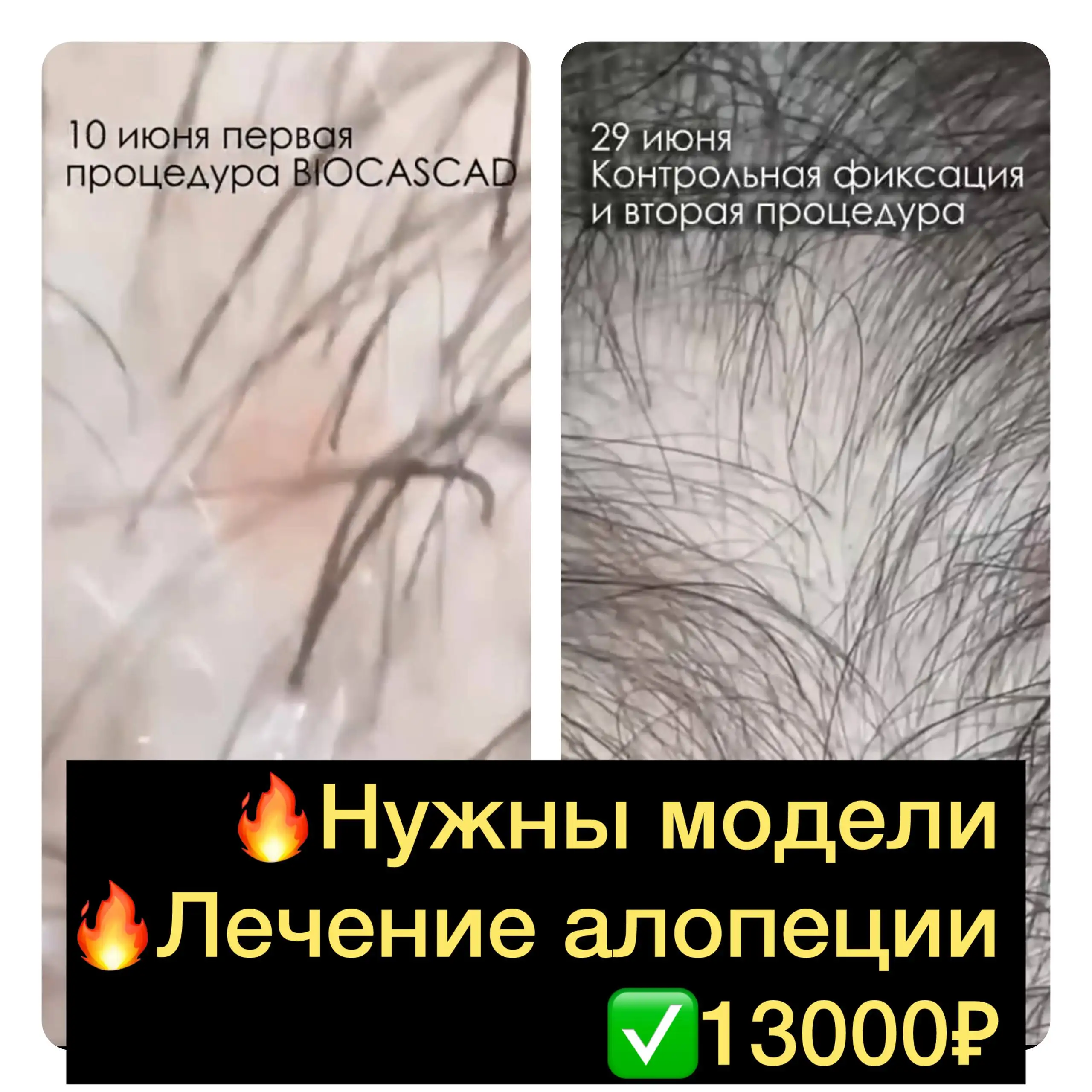 Кресло-качалка - Мебель (Для дома и дачи) в Сургут