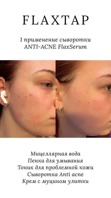 Профессиональная уходовая косметика FLAXTAP и косметологические услуги в Самаре - частное объявление в Самара