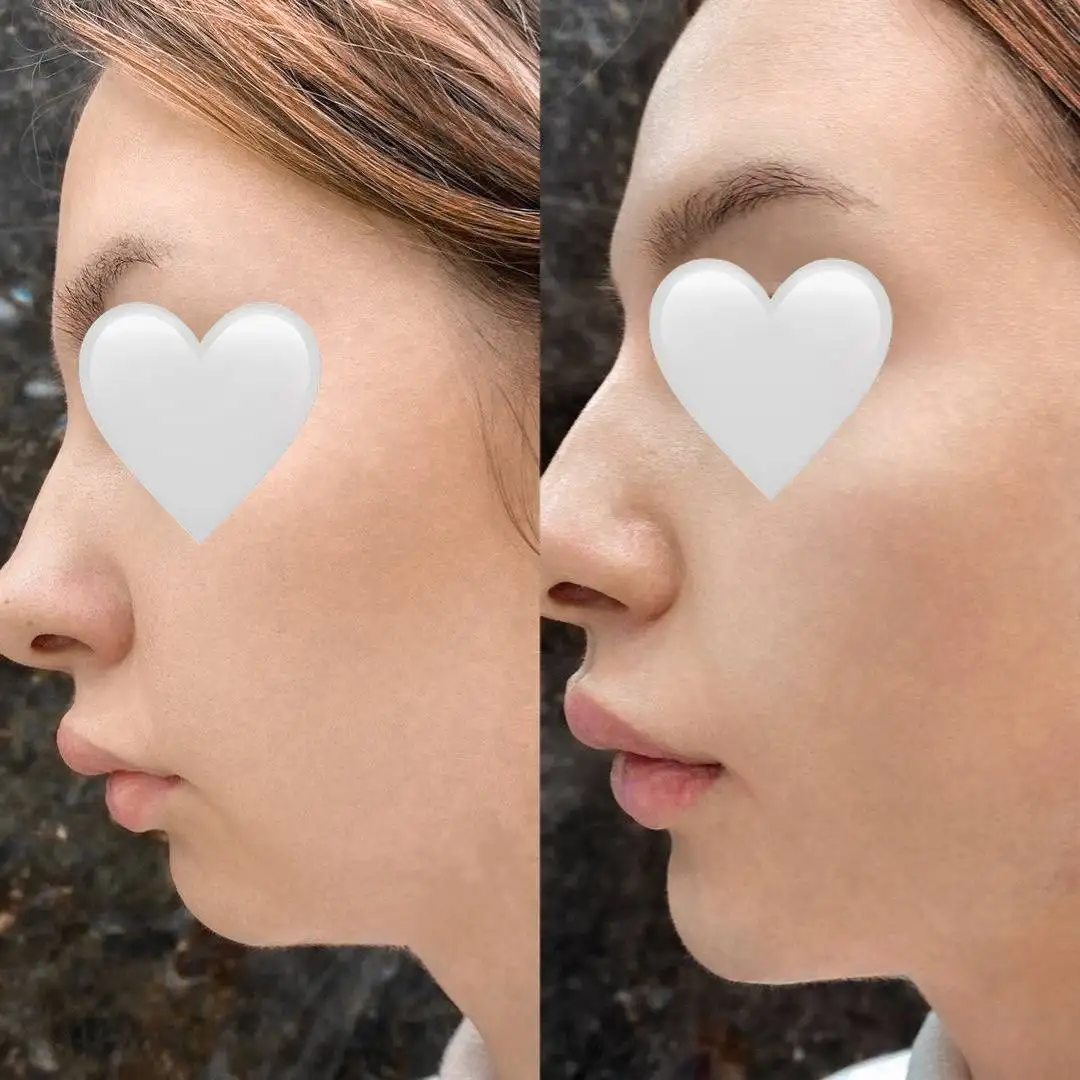 Косметологические услуги и перманентный макияж в Самаре - Красота и здоровье (Услуги) в Самара