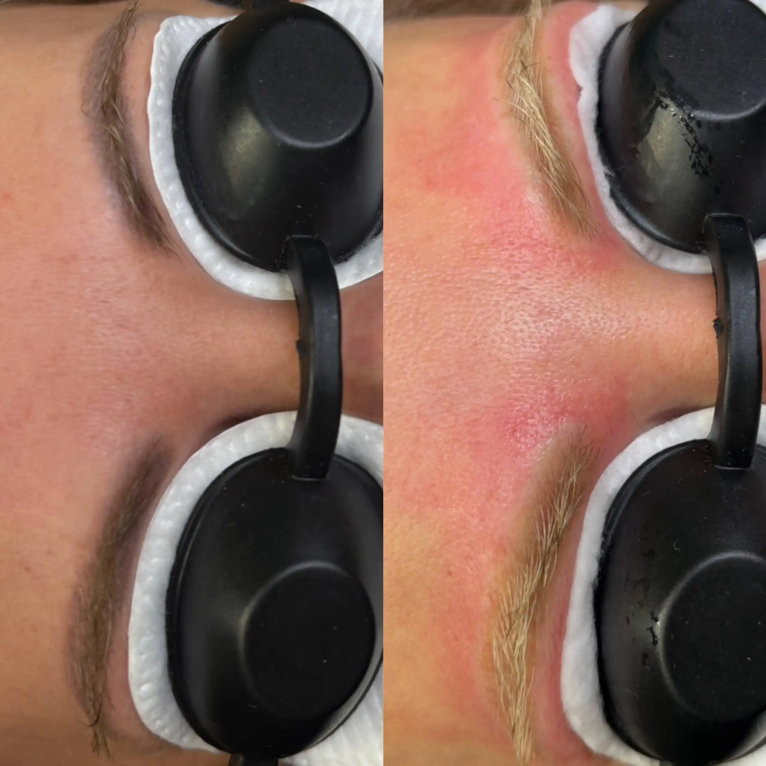 Косметологические услуги и перманентный макияж в Самаре - Красота и здоровье (Услуги) в Самара