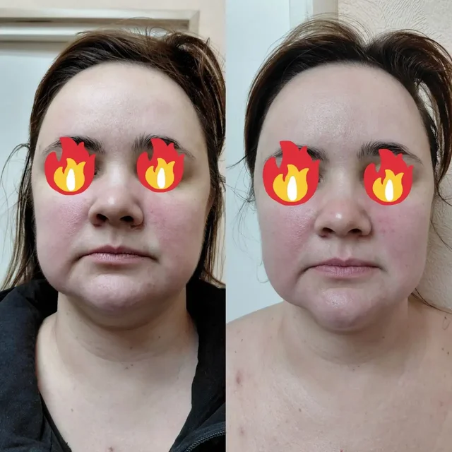 Авторский массаж лица от косметолога с медицинским образованием - Благоустройство территории в Самара