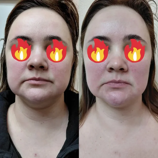 Французский скульптурный массаж лица - Косметика в Самара