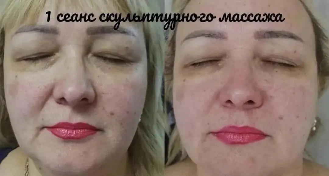 Французский скульптурный массаж лица - Косметологические услуги (Красота и здоровье) в Самара