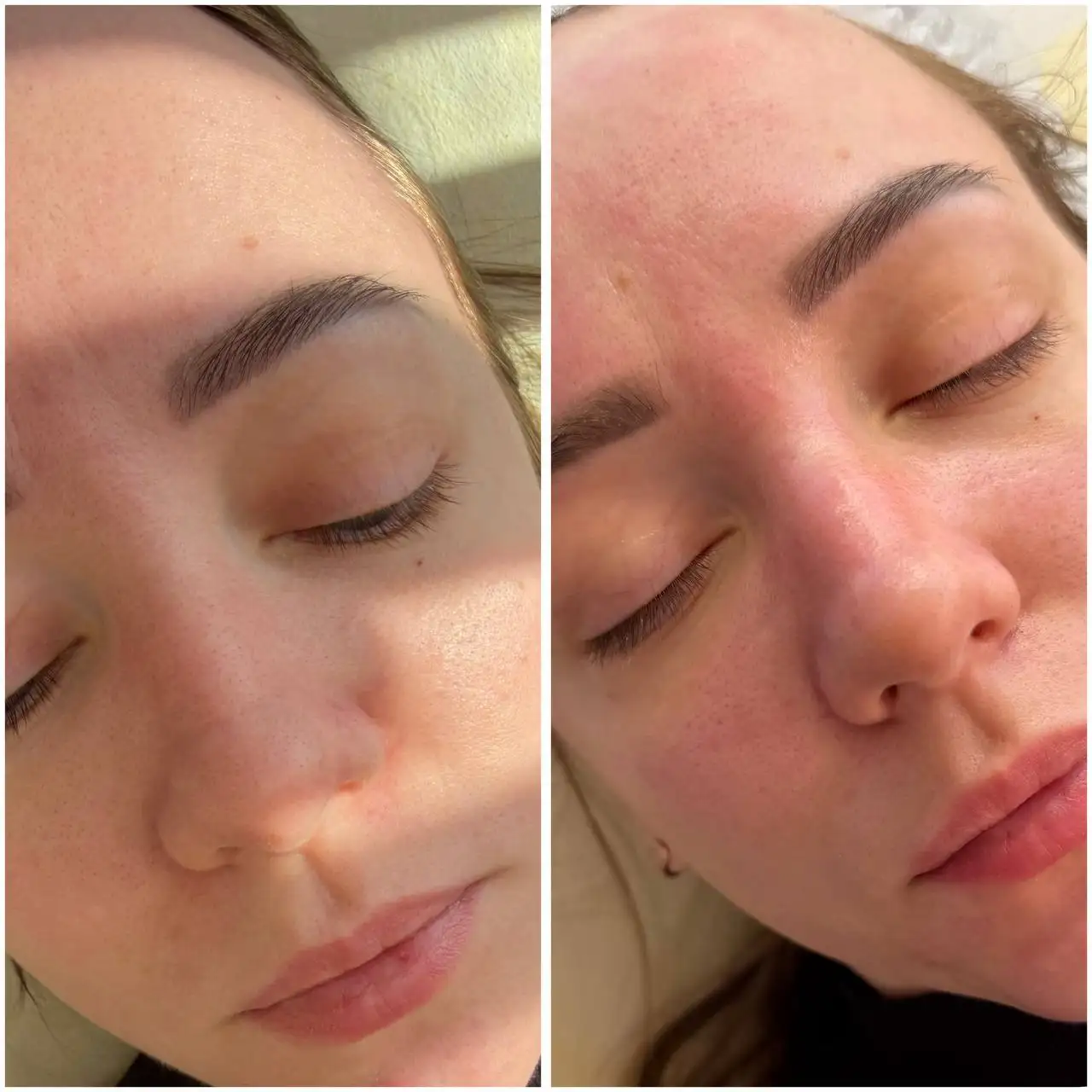 Профессиональная чистка лица в Улан-Удэ - Косметология (Услуги) в Улан-Удэ