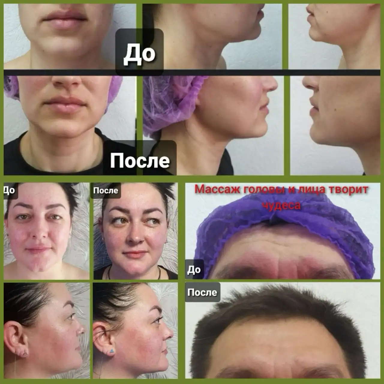 Новогоднее преображение массажем