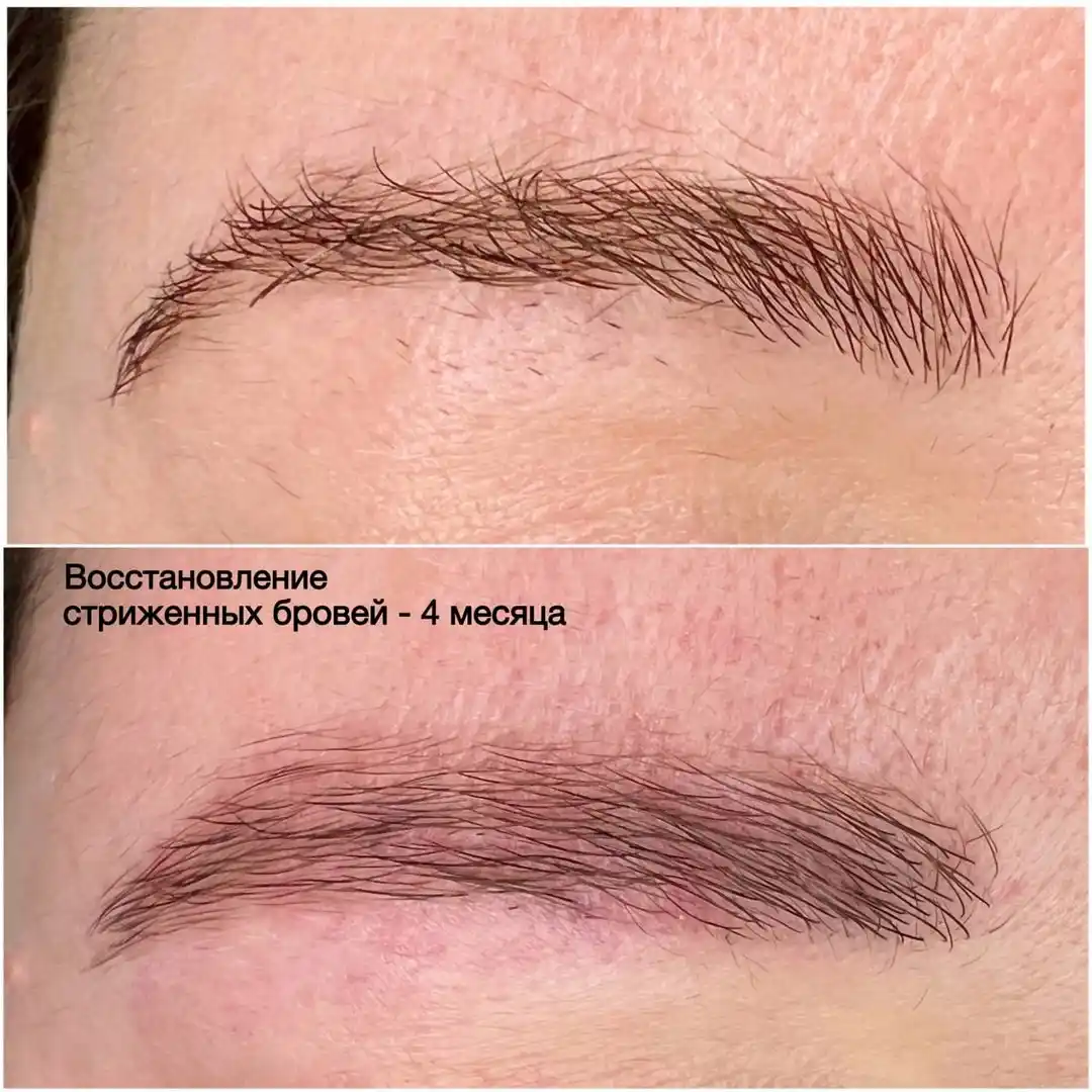 Эко-реновация бровей