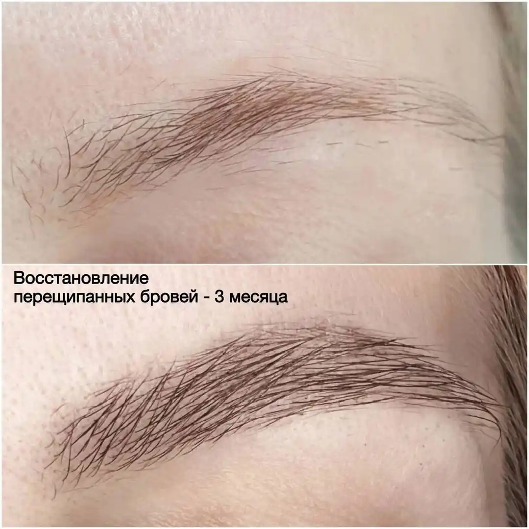 Эко-реновация бровей