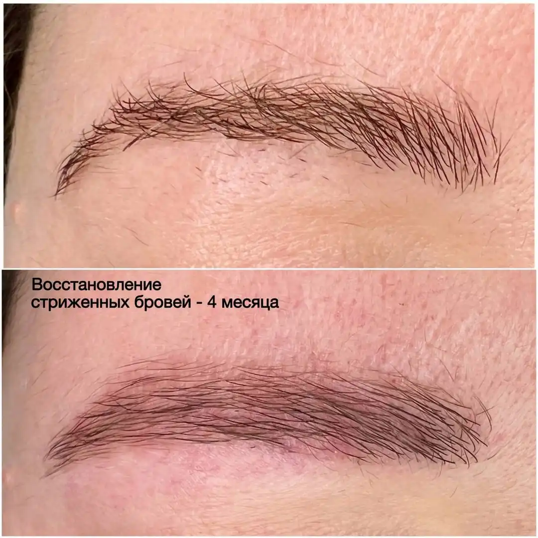 Эко-реновация бровей