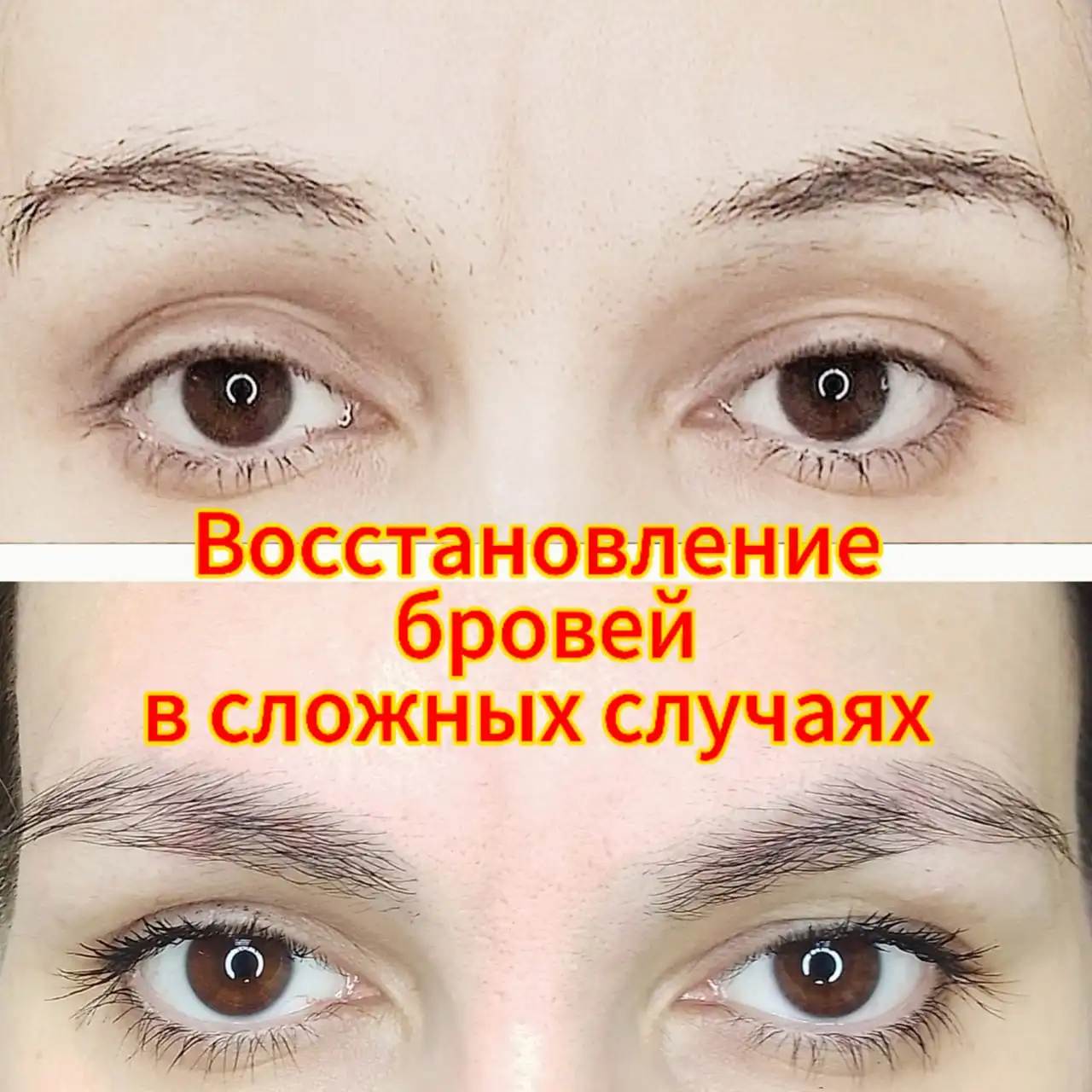 Эко-реновация бровей: новый подход к восстановлению натуральных бровей - Брови (Красота и здоровье) в Ульяновск