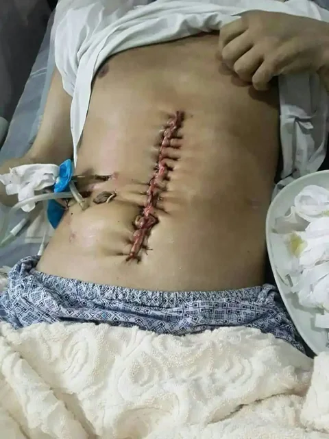 Просьба о помощи для нуждающегося земляка из Самарканда после аварии - Услуги в Хабаровск