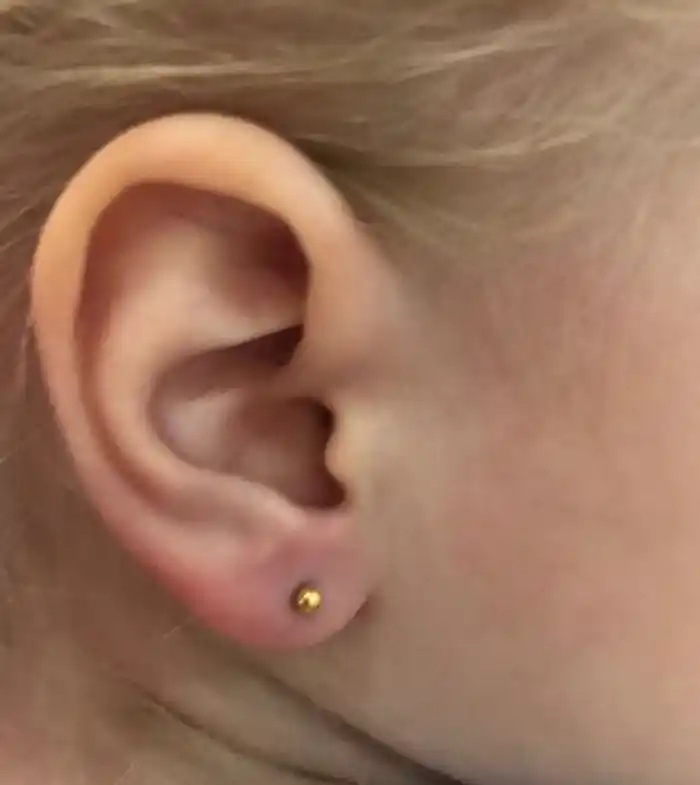 Прокол ушей пистолетом