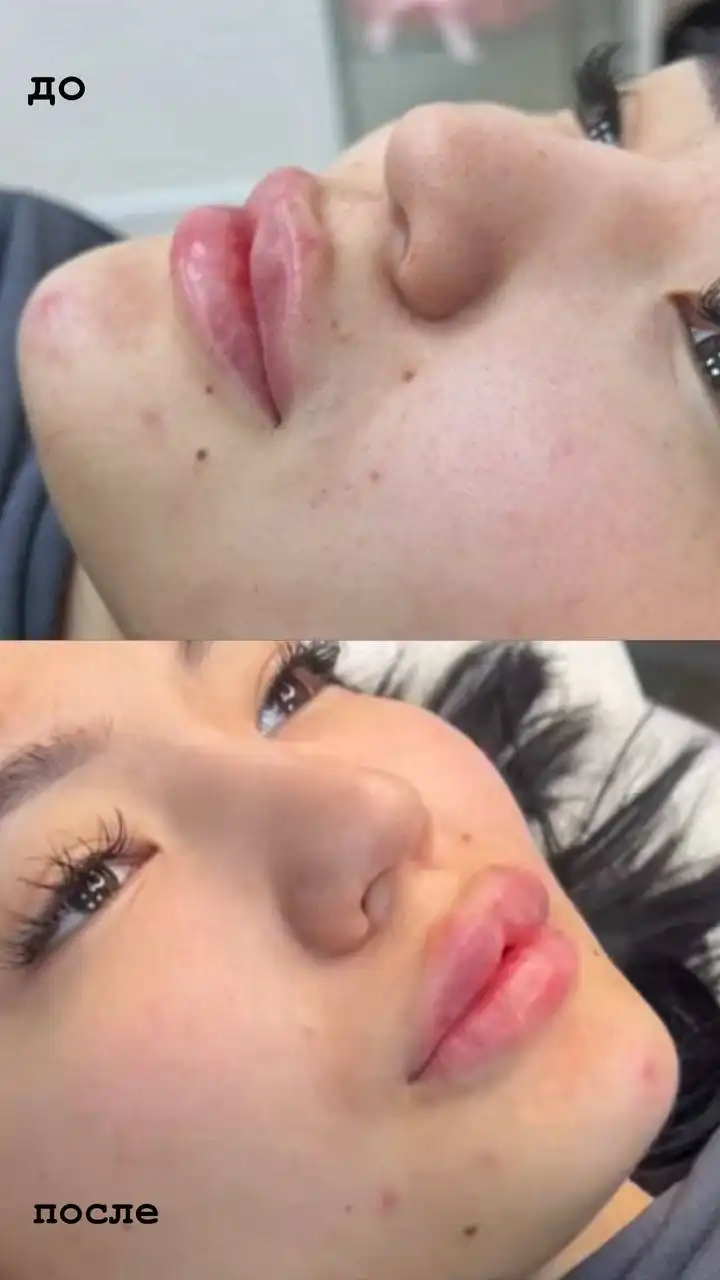 Косметологические услуги в Сургуте - Косметология (Красота и здоровье) в Сургут