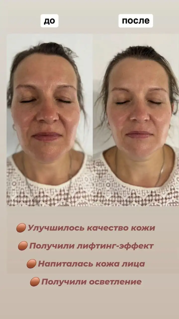 Модели для процедуры архитектура красоты в студии эстетической косметологии - Косметология (Услуги) в Волгоград