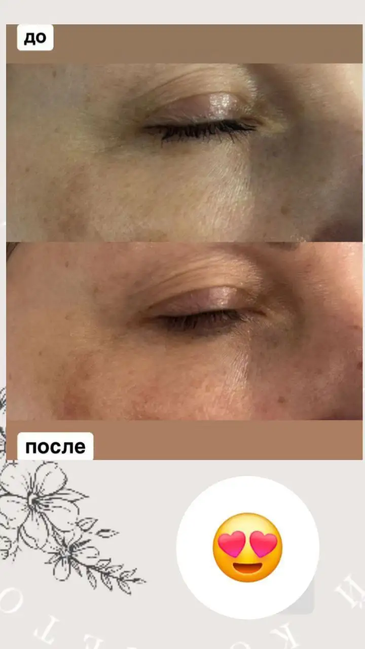 Модели для процедуры архитектура красоты в студии эстетической косметологии - Косметология (Услуги) в Волгоград