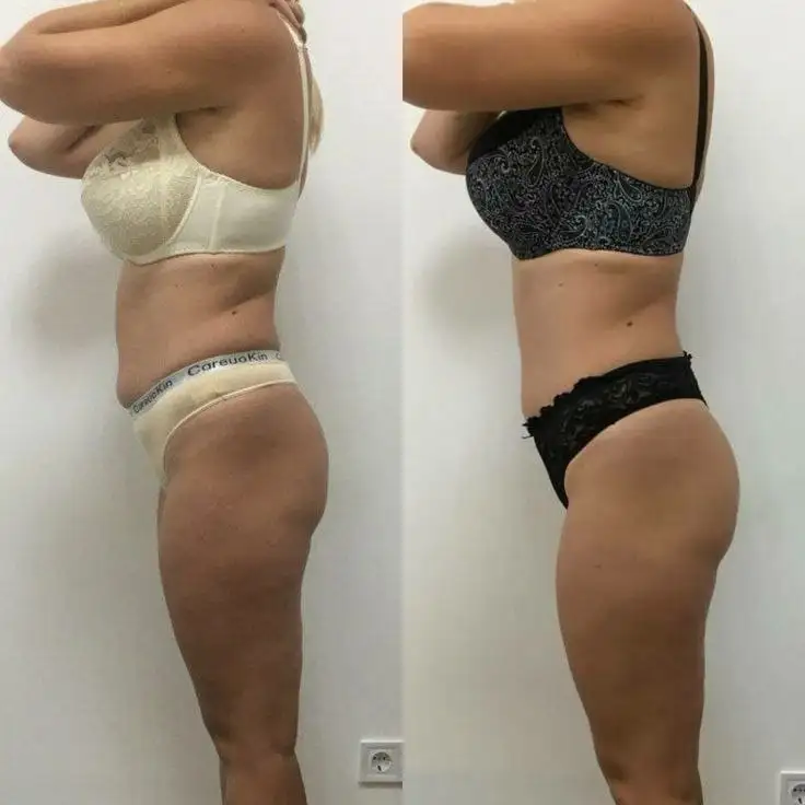 WOW-предложение для красивой фигуры - Косметология (Красота и здоровье) в Волгоград