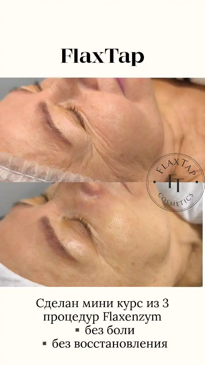 Услуги косметолога-эстетиста в Оренбурге - Красота (Услуги) в Оренбург