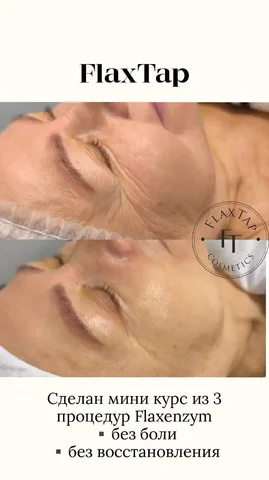 Услуги косметолога-эстетиста в Оренбурге - Флористика в Оренбург