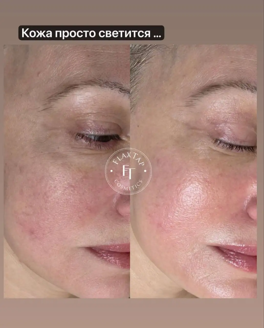 Ягодная терапия для кожи с ферментными масками - Красота и здоровье в Оренбург