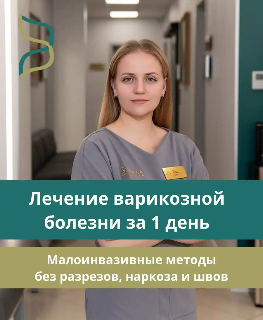 Лечение варикоза в Тольятти без операции