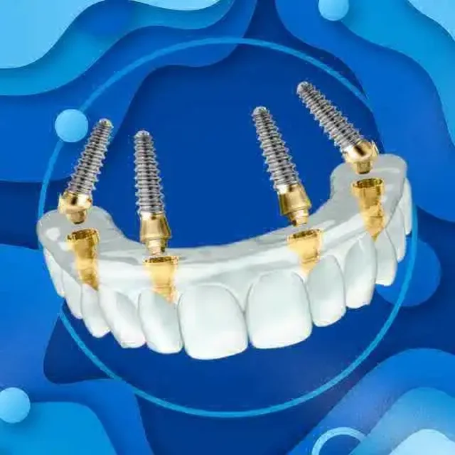 Восстановление челюсти по швейцарскому методу - Кулинария/Кондитерские услуги в Тольятти
