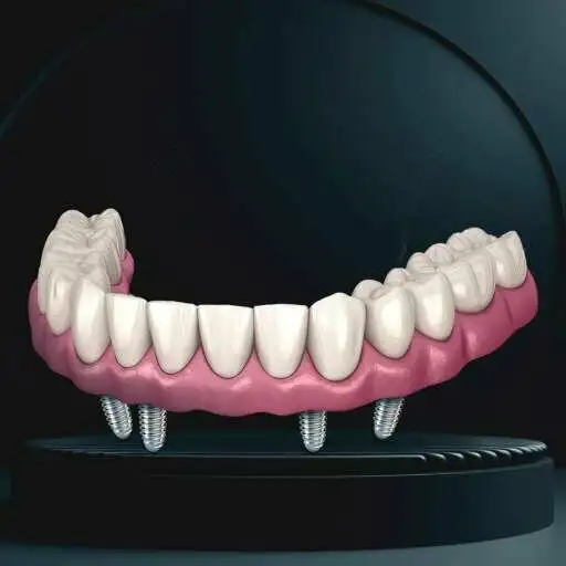 Имплантация «Все зубы сразу» в Самаре - Медицинские услуги (Услуги) в Самара