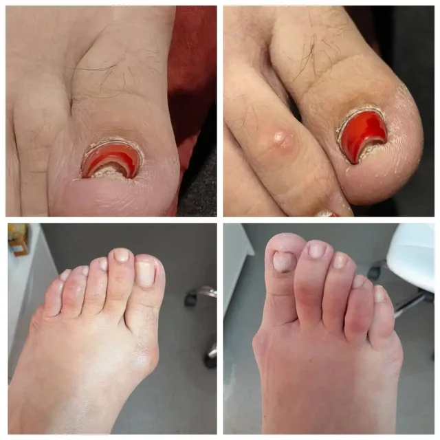 Услуги подологии в Иркутске - Услуги в Иркутск