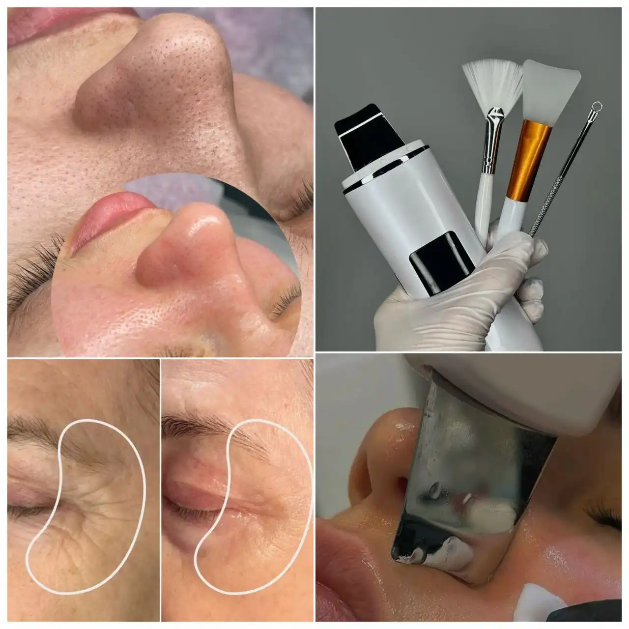 Услуги косметолога-эстетиста в Иркутске - Косметология (Красота и здоровье) в Иркутск