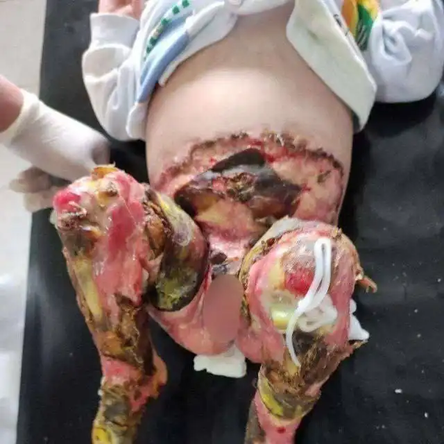 Просьба о помощи для ребёнка - Барахолка в Омск