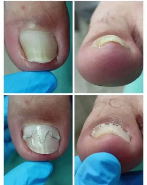 Стажировка моделей в центр подологии - Образовательные услуги в Челябинск