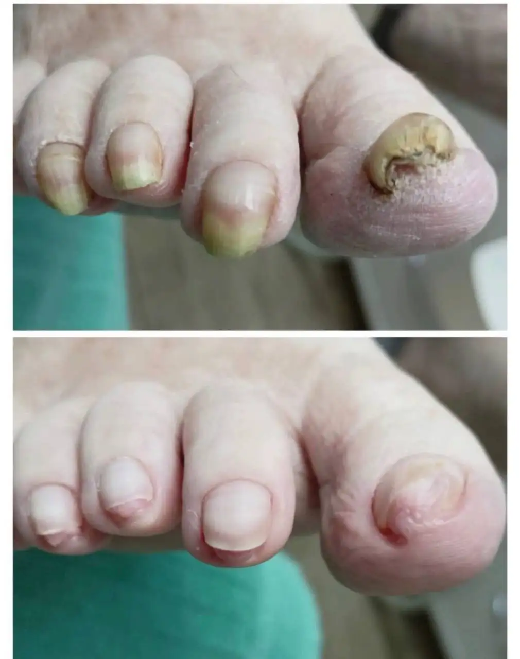 Нужны модели для стажировки подолога - Медицинские услуги (Услуги) в Челябинск