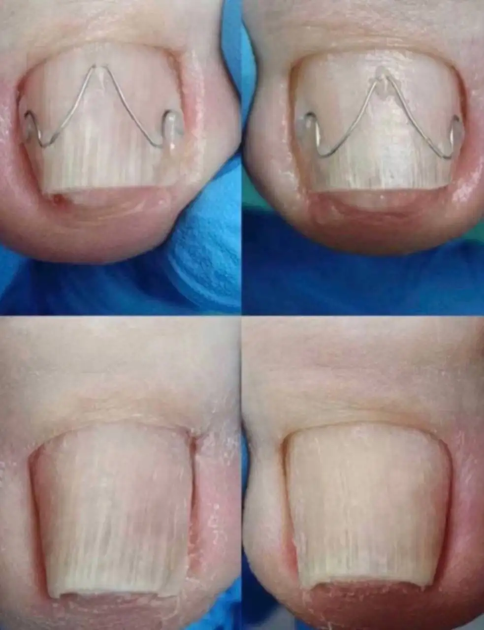 Требуются модели для стажировки подолога - Медицинские услуги (Услуги) в Челябинск