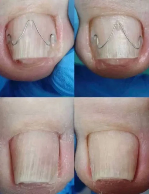 Требуются модели для стажировки подолога - Услуги в Челябинск