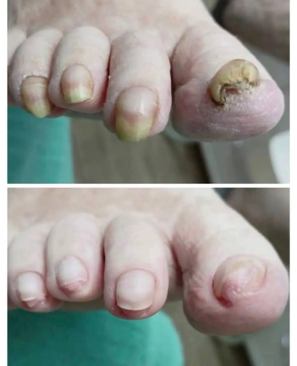 Требуются модели для стажировки подолога - Медицинские услуги (Услуги) в Челябинск