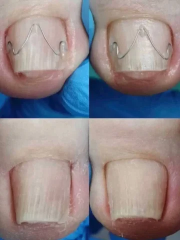 Требуются модели для стажировки подолога со скидкой - Работа в Челябинск