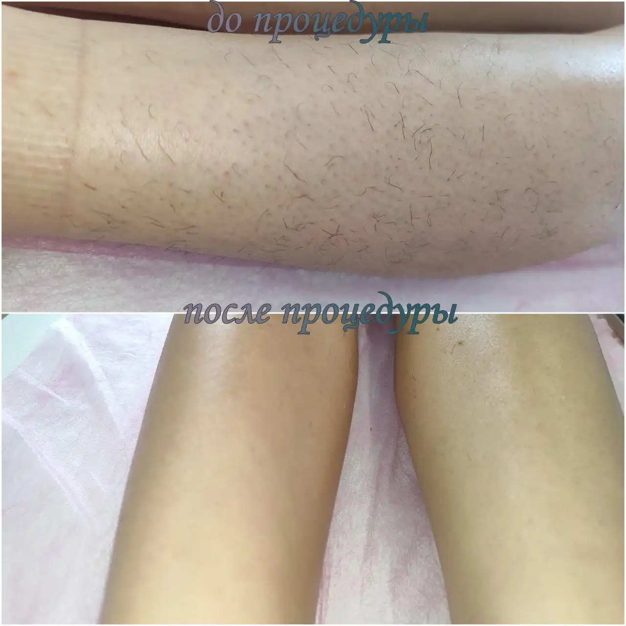 Услуги мастера восковой депиляции и шугаринга