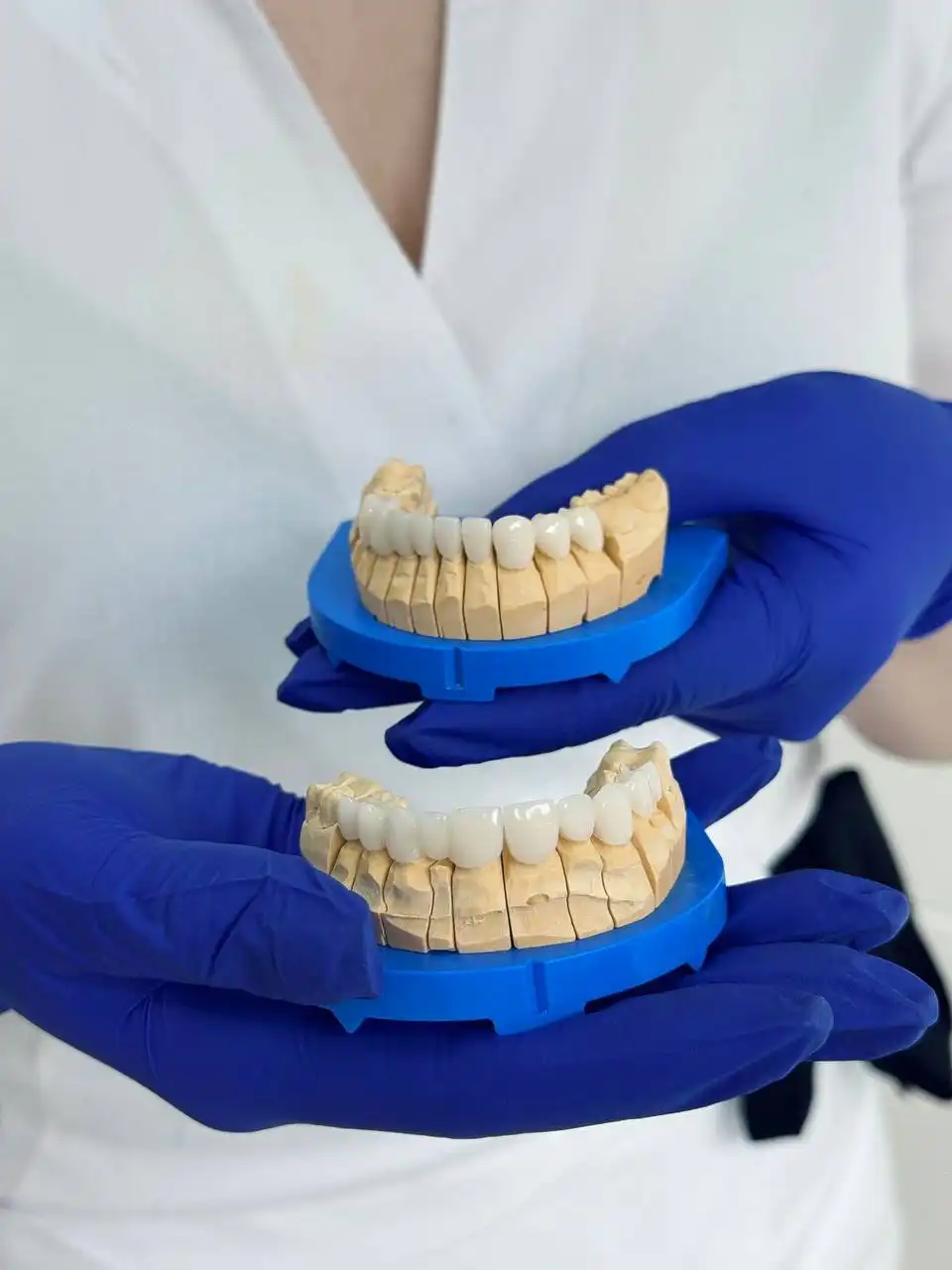 Скидка на металлокерамические коронки