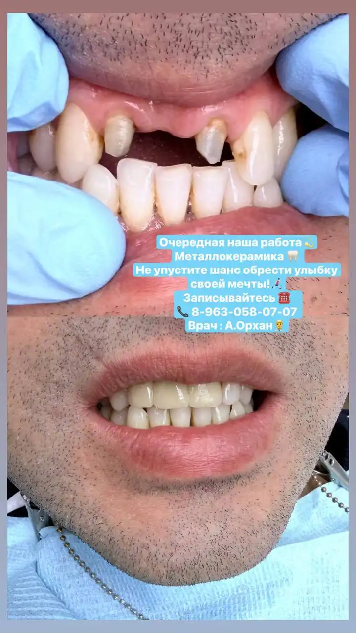 Консультация врача А. Орхана - Медицинские услуги (Услуги) в Тюмень