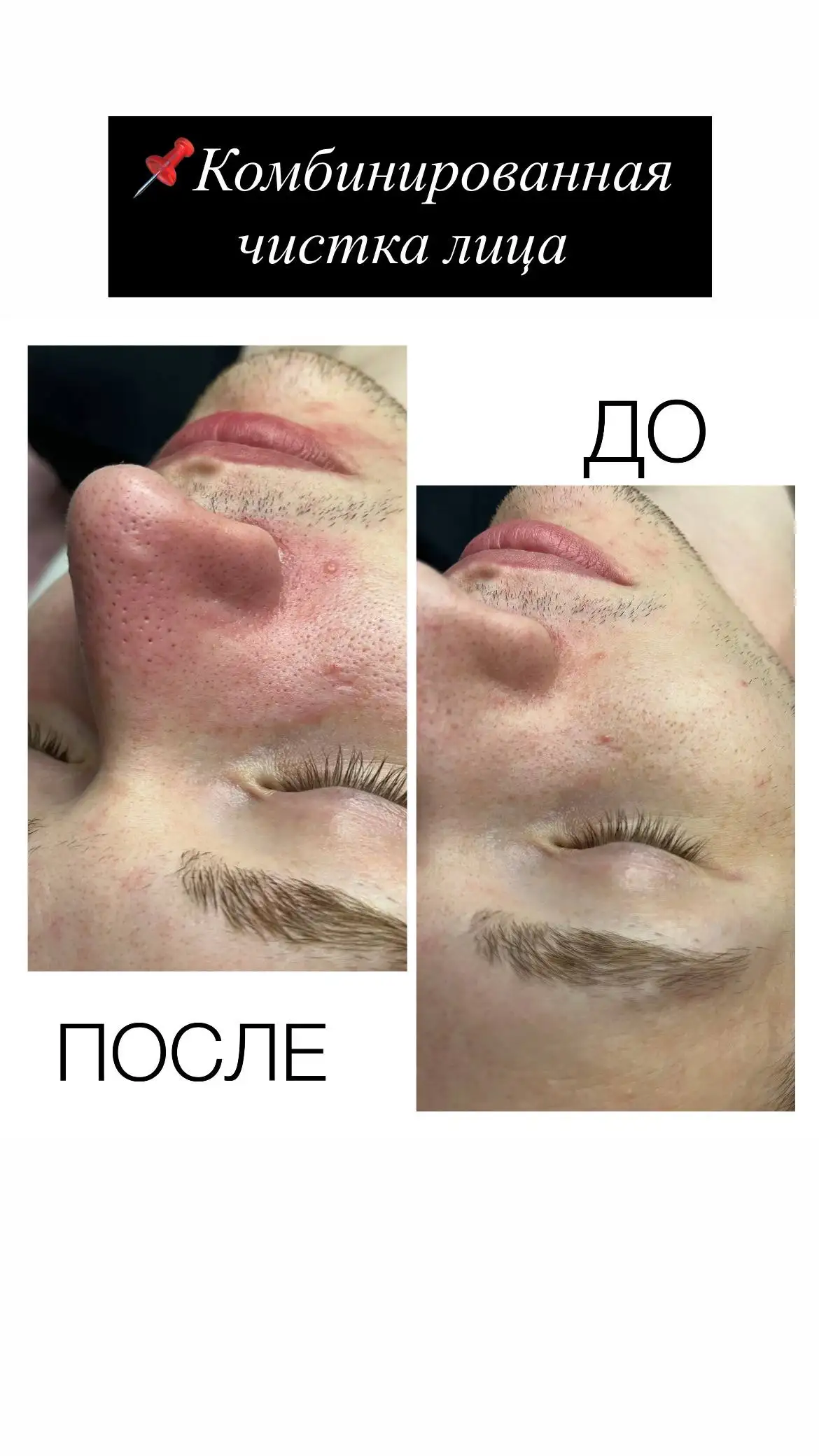 Скидки на уход за кожей - Красота и здоровье (Услуги) в Екатеринбург