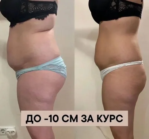 Абонемент на 10 сеансов скетч боди по обертыванию - Обертывания в Екатеринбург