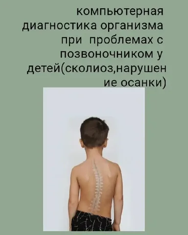 Компьютерная диагностика организма при проблемах с позвоночником у детей - Консультации в Тюмень