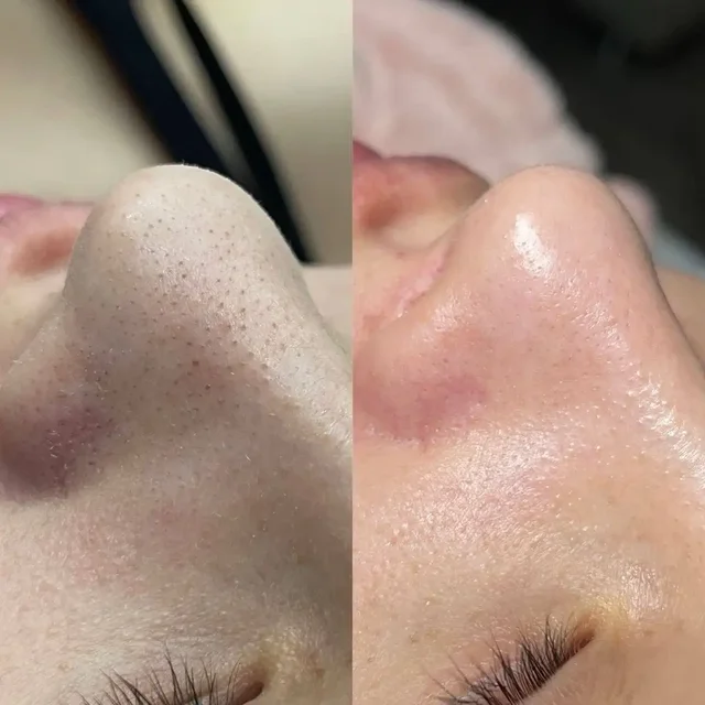 Услуги косметолога в Тюмени - Гигиена полости рта в Тюмень