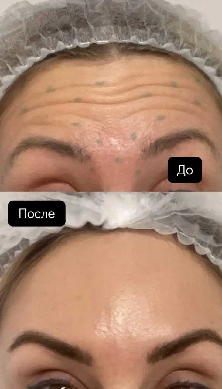 Услуги косметолога в Тюмени - Косметология (Красота и здоровье) в Тюмень